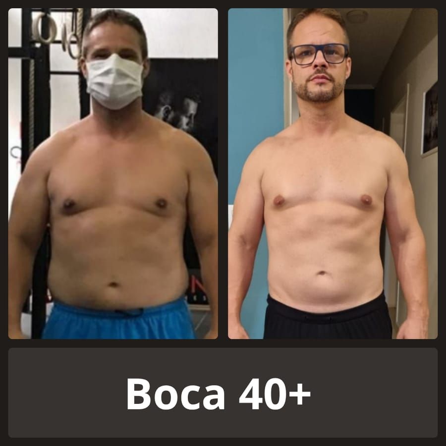 Antes e depois — Boca, 40+